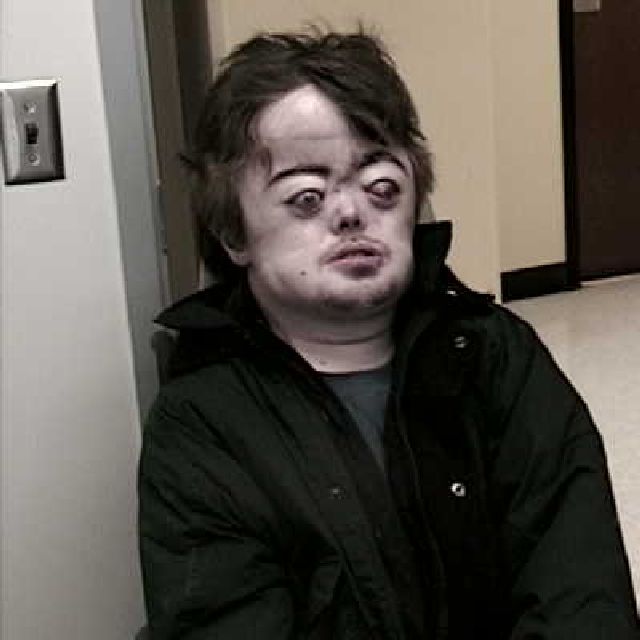 Attached Image