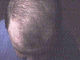 Attached Image