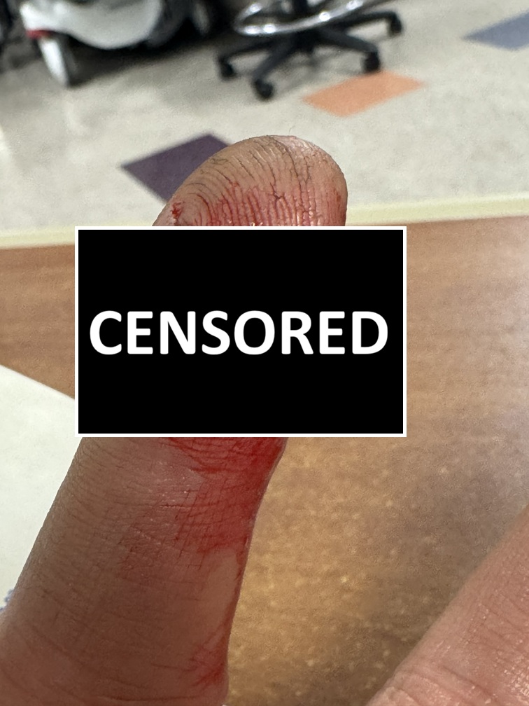 Attached Image