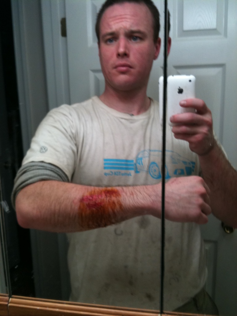 Accident With Angle Grinder Warning Page For A Bodies Only Mopar Forum